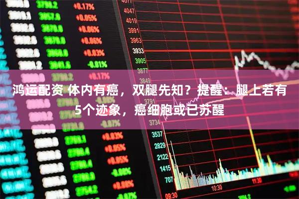 鸿运配资 体内有癌，双腿先知？提醒：腿上若有5个迹象，癌细胞或已苏醒